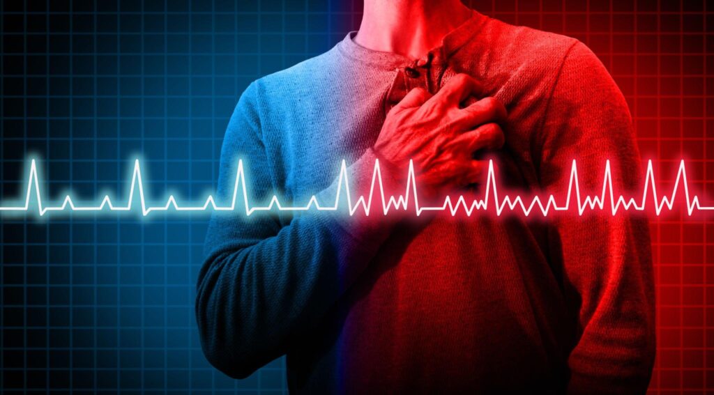 heart health - Heart disorder and atrial fibrillation ecg as a coronary cardiac attack
